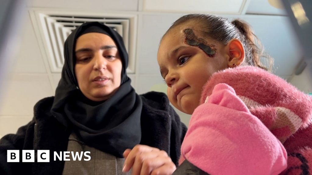 BBC joins Gazan girl, 2, in Jordan on journey to life-saving treatment