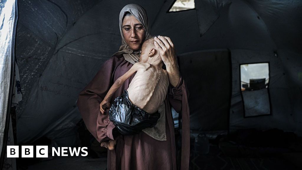 The story behind the photograph of a starving Gaza baby
