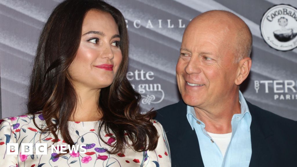 Bruce Willis’s wife says he is in great health but brain failing
