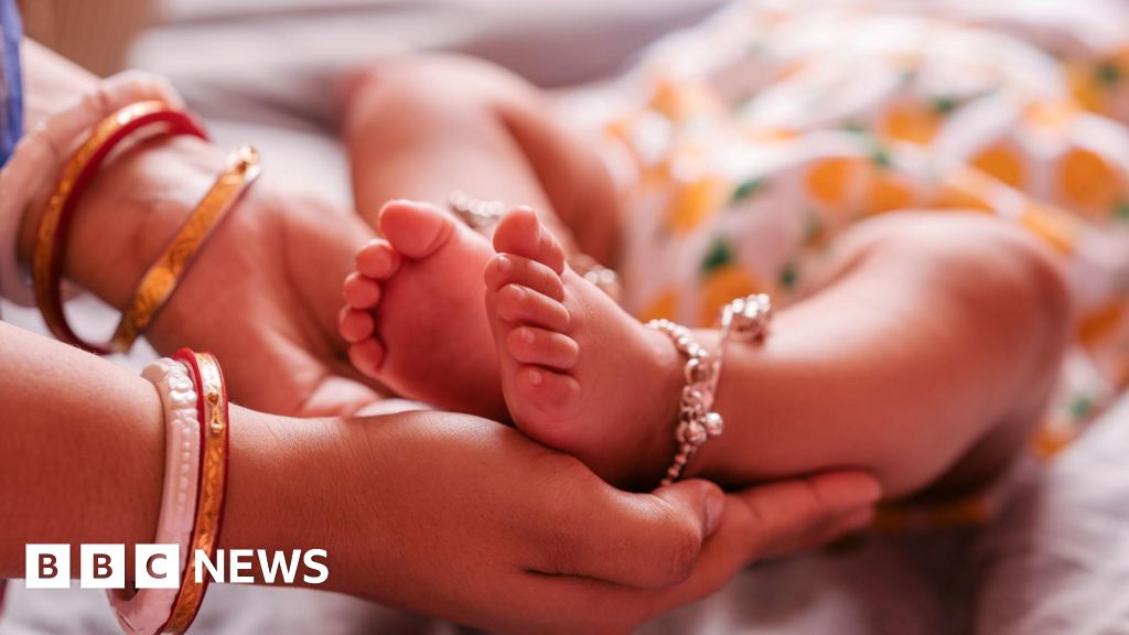 Indian doctors remove rare parasitic twins from baby’s stomach